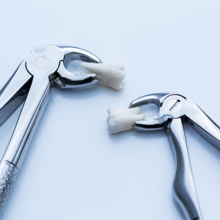 Extração de ciso Implante dentário moderno Sorocaba Lentes de porcelana Sorocaba