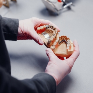 Protese removível Facetas de resina Votorantim Harmonização orofacial estética Votorantim